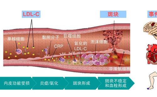 低密度脂蛋白胆固醇偏高是怎么回事-为什么会低密度脂蛋白胆固醇偏高