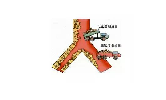 高密度脂蛋白胆固醇偏低什么意思-高密度脂蛋白胆固醇偏低什么含义