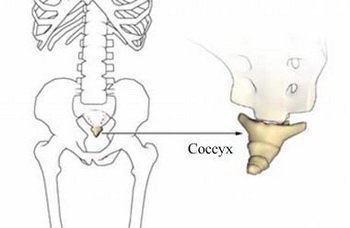 屁股尾椎骨疼怎么回事-屁股尾椎骨疼的原因是什么