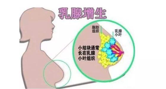 乳腺增生的治疗方法-治疗乳房增生的方法有哪些