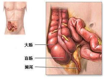 阑尾炎是在左边还是右边-阑尾炎在哪