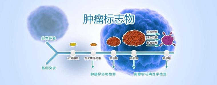 CA19-9指标增高怎么办？