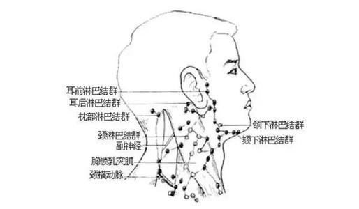 淋巴结节是怎么回事-导致淋巴结节疾病有哪些