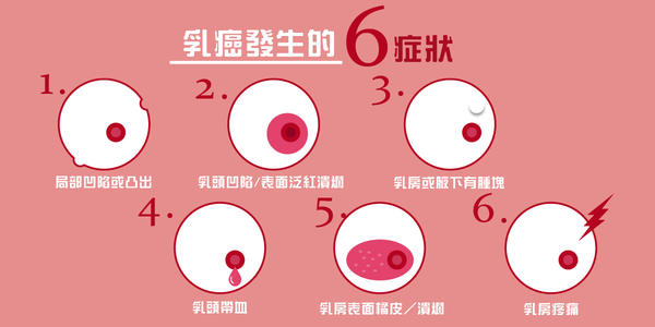 乳腺癌的前兆-乳腺癌的前兆有哪些