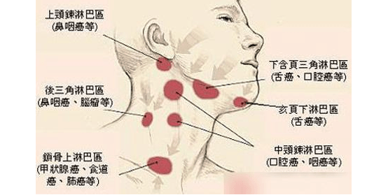 淋巴结良性跟恶性区分-淋巴结良性跟恶性区别