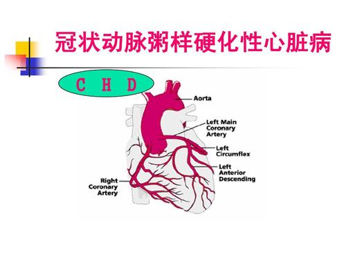 冠状动脉斑块能消除吗-冠状动脉斑块能不能消除