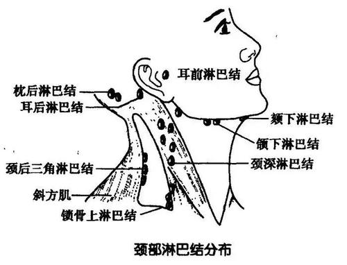 为什么淋巴结肿大-淋巴结肿大的原因有哪些