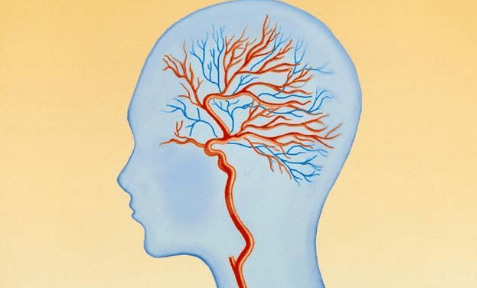 脑供血不足的怎么调理-脑供血不足的怎么办