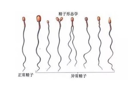 精子黄颜色正常吗-精子黄颜色是正常的相关介绍