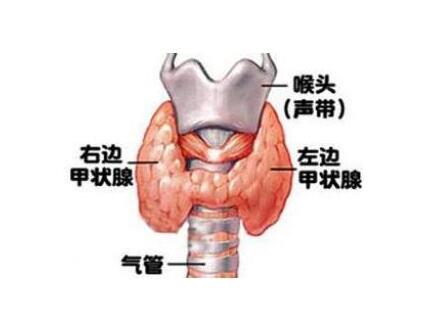 甲状腺乳头状癌寿命-甲状腺乳头状癌寿命有多少