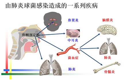 这六种癌症信号早知道 感冒老不好小心鼻咽癌