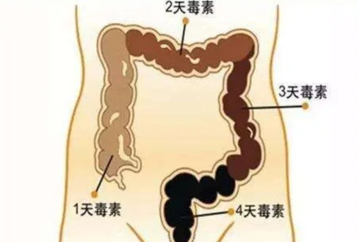 怎样看拉出来的是宿便-排宿便什么样算是排干净了