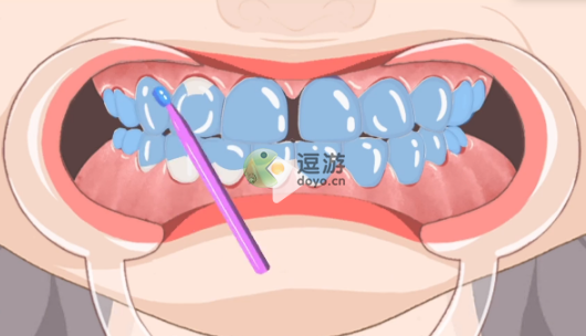 收纳达人闪闪牙钻教程攻略