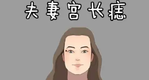 夫妻宫有痣的女人好不好 夫妻宫有痣的女人可以去掉吗