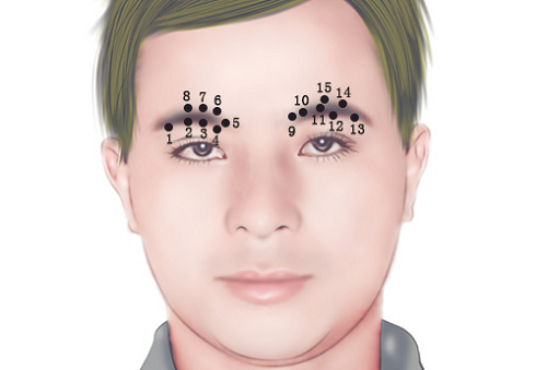 锁眉痣长在哪里图片 锁眉痣的人命运