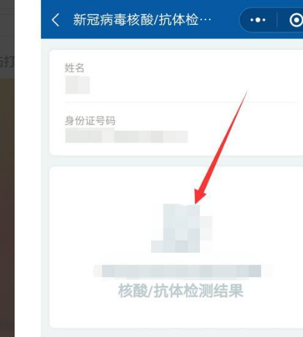 儿童没手机核酸检测怎么查询 