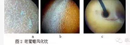 烤色蜜蜡价值、鉴别、知识大全