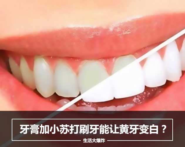 用小苏打刷牙牙齿会变白吗 牙齿发黄你可以这么做