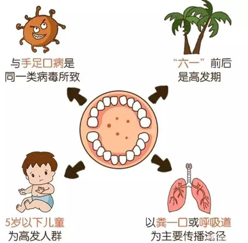 手足口病不能吃什么,手足口病的饮食原则