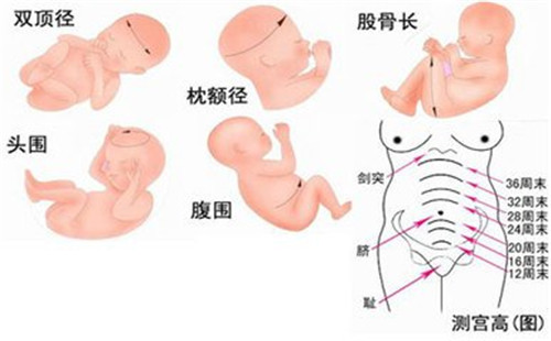 34周胎儿双顶径标准是多少,34周胎儿双顶径过大怎么办