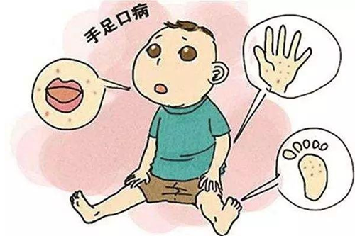 小孩子得了手足口病怎么办 得了手足口病不治疗能好吗