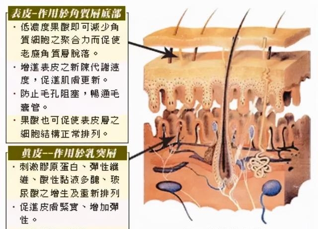 刷酸结果爆了满脸的闭口怎么办（刷酸必看的注意事项）