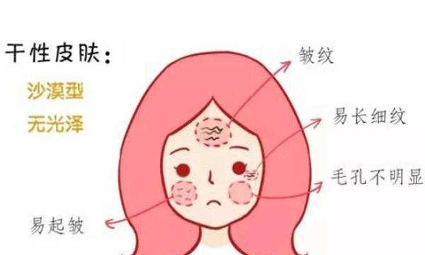 干性皮肤的特点是什么（干性肌肤的特征及保养）