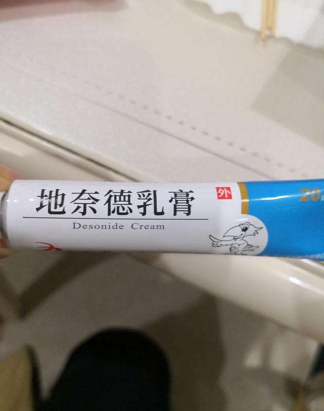 隐翅虫咬后最有效的处理方（亲测被隐翅虫咬后处理方法）