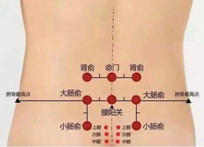 拔罐的禁忌和注意事项（牢记拔罐5个注意事项）